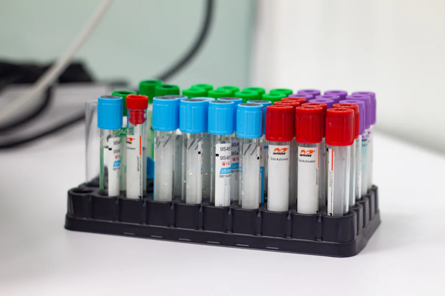 Rack of color-coded blood sample tubes in a clinical lab at Biofuse Wellness Center, used for precise diagnostic testing and wellness assessments.
